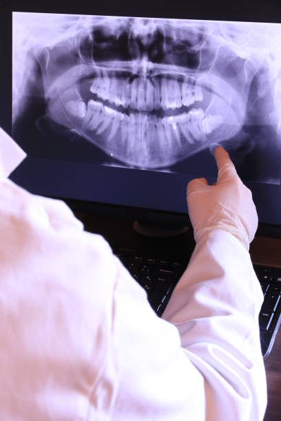 Best Same-Day Emergency Dental Services in Ann Arbor, MI