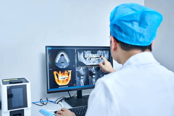 Best Emergency Tooth Extraction in Ann Arbor, MI
