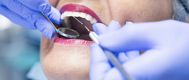 Best Emergency Treatment for Dental Infections or Abscesses in Ann Arbor, MI